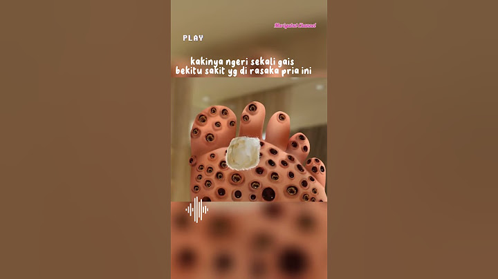 kaki berlubang banyak hewan aneh di dalm #shorts #alurcerita #viral #asmr