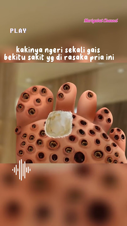 kaki berlubang banyak hewan aneh di dalm #shorts #alurcerita #viral #asmr
