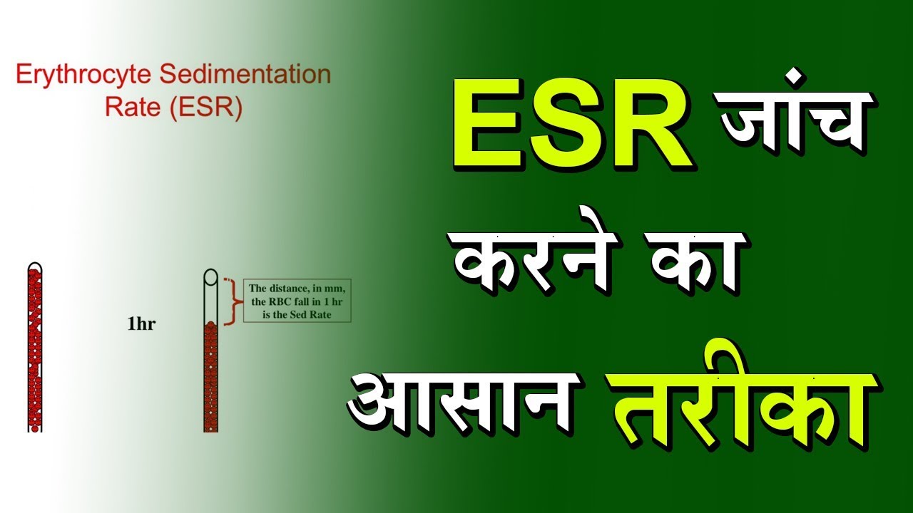 Blood Test Erythrocyte Sedimentation Rate (ESR) By DPMI YouTube