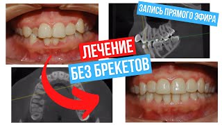 : Invisalign -   . .   ?     .