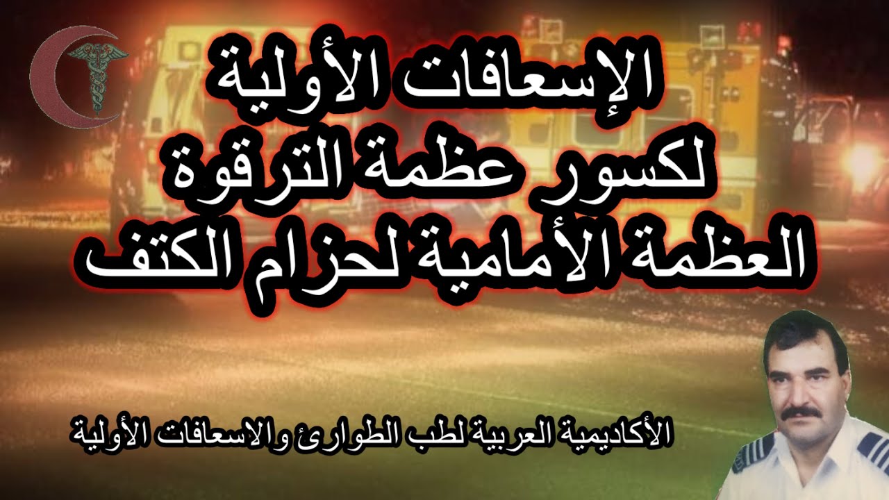 تثبيت وتجبير اصابات كسور #عظمة_الترقوة _للكتف#اسعافات_اولية #طوارئ اسعاف #طوارئ #عبدالقادر صوالحة