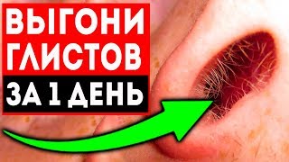 Соседка рассказала, как на утро вылез ком паразитов! Смешала обычные...