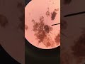 Water Mite in Pond Water 🕷 💧