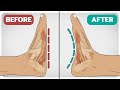 5 exercises to fix flatfeet fallen arches