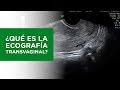 ¿Qué es la Ecografía Transvaginal?