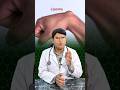 Right Stage Of Lipoma Treatment Shorts Ytshorts Lipoma Right Stage Of Lipoma Treatment Shorts Ytshorts Lipoma
