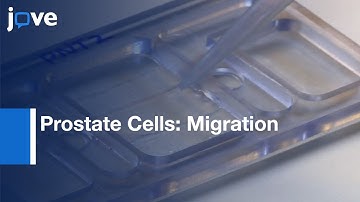 Directional Migration Of Prostate Cells:Utilizing Custom-designed Galvanotaxis Chambers