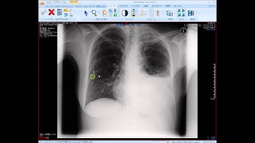 CARESTREAM Vueクラウドサービス　（データセンター）　デモビデオ