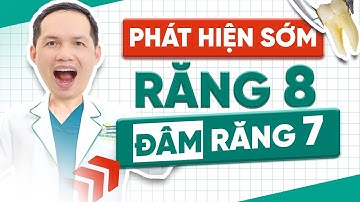 Cảnh Báo: Răng Số 8 Đâm Răng Số 7 Rất Nguy Hiểm | Nha Khoa Hina