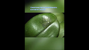 ЧТО С ЛИСТЬЯМИ ОРХИДЕИ?