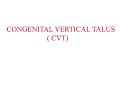 Congenital Vertical Talus