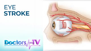 EYE STROKE: Central Retinal Artery Occlusion | Doctors on TV