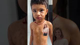 Hair Removal Ubtan For Baby Magic Ubtan For Babys Smooth Skin Safe & Natural Hair Removal