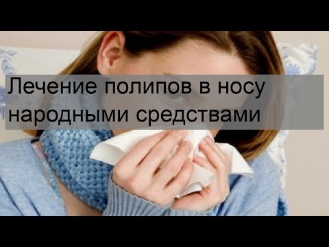 Лечение полипов в носу народными средствами