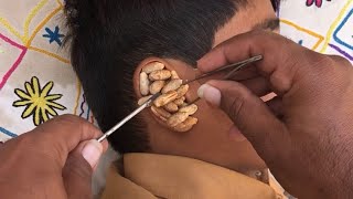 ASMR Ear Cleaning | Deep Relaxing Sounds for Sleep 👂 