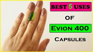 Evion 400 : Unbelievable Top 5 Uses of Vitamin E Capsules for Skin  | विटामिन इ कैप्सूल्स के फायदे