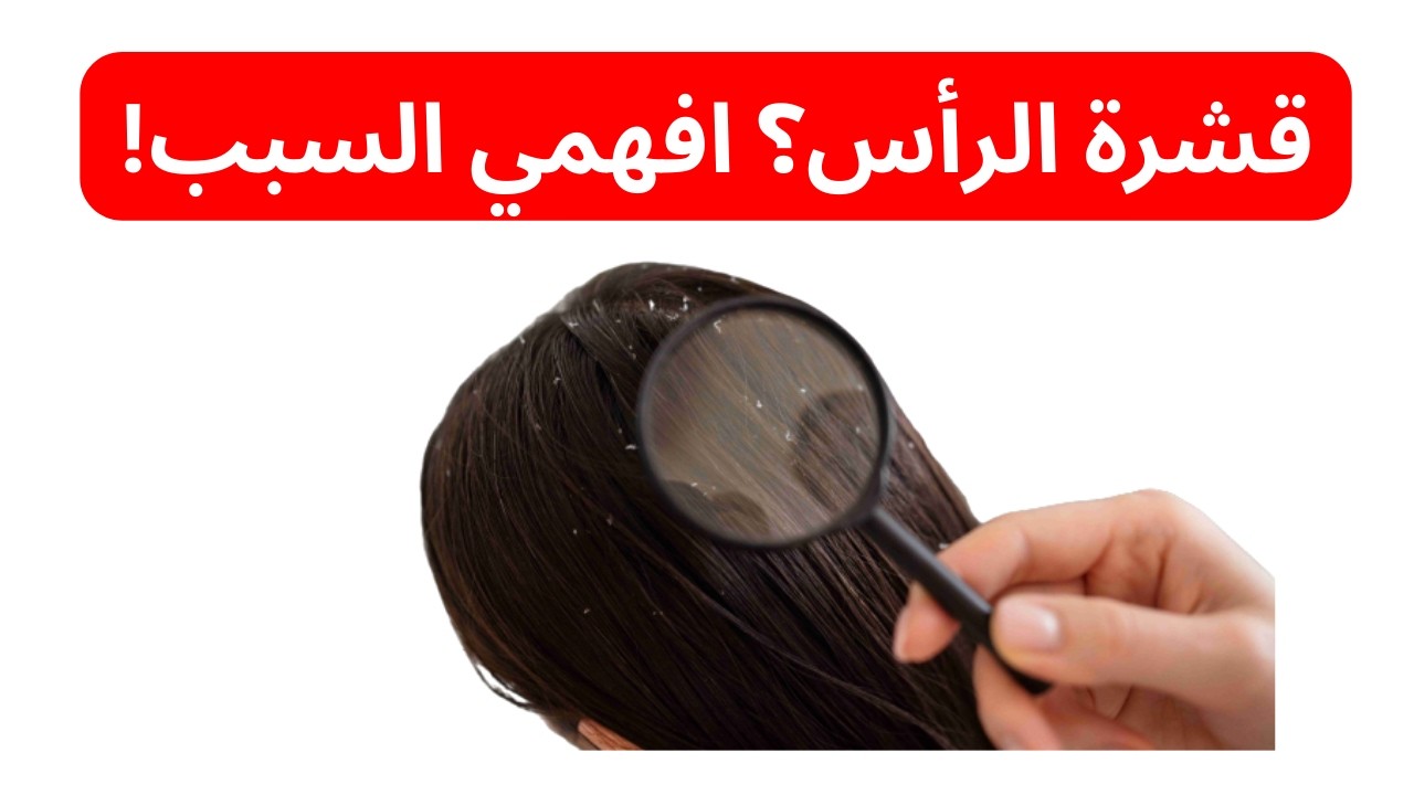 🌿 قشرة الرأس ليست مجرد مشكلة… افهميها أولًا لتعالجيها