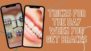 Tricks for the Day You Get Braces #shorts