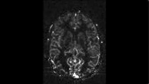 Dynamic flow imaging during visual cortex activation