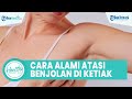 Jangan Panik, Benjolan di Ketiak Bisa Diatasi dengan Bahan Dapur: Kompres Air Hangat & Jus Lemon