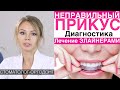 НЕПРАВИЛЬНЫЙ ПРИКУС - диагностика, лечение неправильного прикуса элайнерами (капами). Подготовка