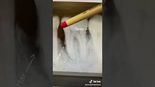 Celebrity Do You Need a Professional Deep Cleaning? #shorts Profile