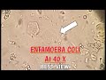 Entamoeba Coli best view in stool microscopy at 40X.E.Coli in stool microscopy.Parasites in stool.