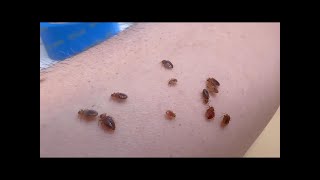 Bed Bugs  What You've Been Told is Totally False,  तिलचट्टे के बारे में, ছারপোকা সম্পর্কে