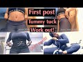 Did I ruin my Tummy Tuck results by working out to soon? | J Sculpt fitness belt!