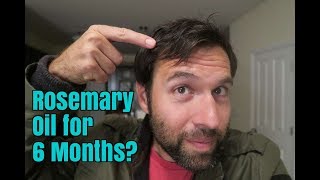 Rosemary Oil for My Hair Loss: Photos Before and After, 6 Month Experiment