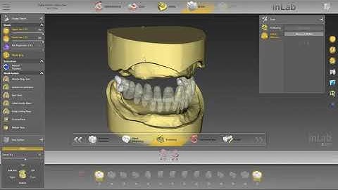 Tutorial 3: inLab SW20 – Digital Denture – Design-Phase - IPN 3D Digital Denture Teeth