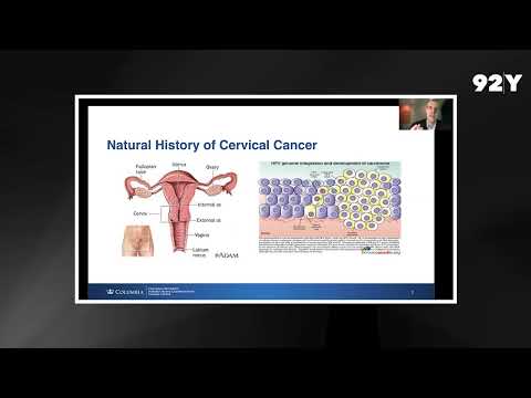 Cervical Cancer Health Talk with Dr. Jason Wright