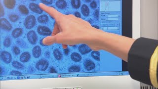 CDC pauses testing for several viruses