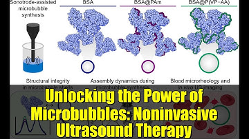 Unlocking the Power of Microbubbles: Noninvasive Ultrasound Therapy