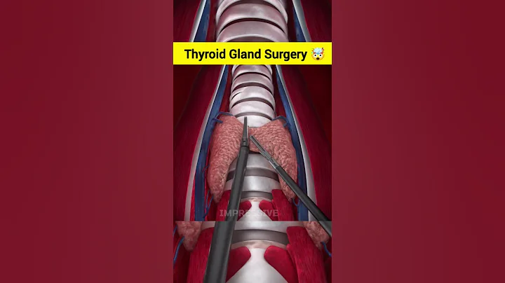 Thyroid Gland Surgery ASMR ANIMATION #shorts #asmr #animation - DayDayNews