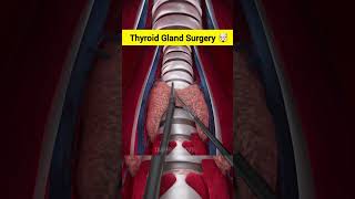 Thyroid Gland Surgery ASMR ANIMATION #shorts #asmr #animation screenshot 2