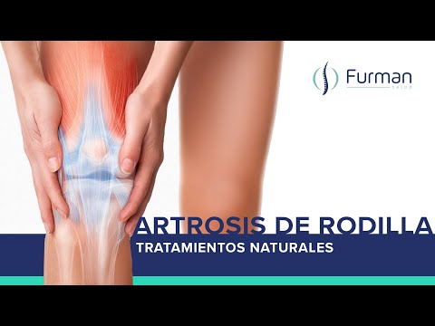 Vídeo: Gonartrosis: Tratamiento De La Gonartrosis Con Remedios Y Métodos Populares