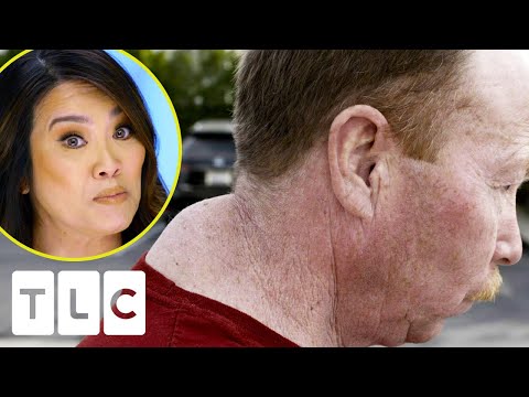 Dr. Lee Pays Tribute To A Man’s Late Wife By Removing His Two Lipomas | Dr. Pimple Popper