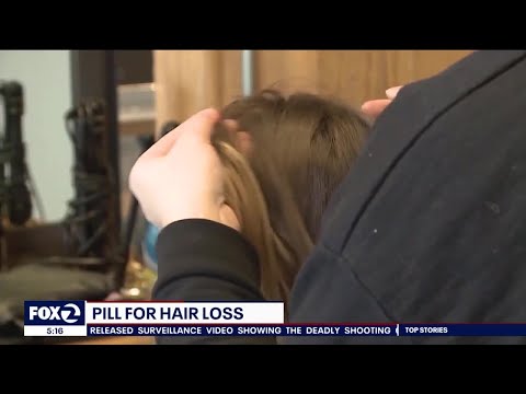Hair Loss Helped By Blood Pressure Medication