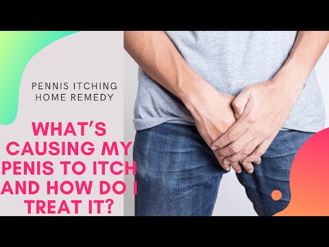 pennis itching home remedy | What’s Causing My Penis to Itch and How Do I Treat It?