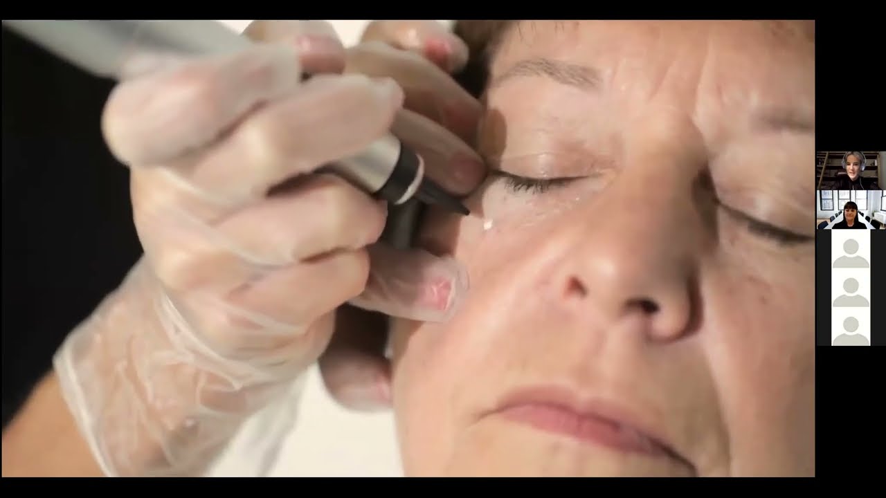 Cryotherapy - Medical Aesthetic Solutions