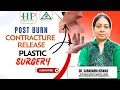 🔥Plastic Surgery REVOLUTIONIZES Post Burn Contracture Treatment|Plastic Surgeon Dr Sarabarni Biswas