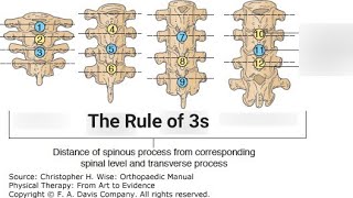 Bony landmarking of the Thoracic Spine(the rule of 3s)#osteopathy , #physicaltherapy , #chiropractic