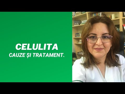 Video: 4 Sfaturi De La Ximena Córdoba Pentru A Scăpa De Celulită
