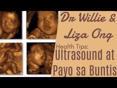 Video: Mga Diagnostic Ng Ultrasound Habang Nagdadalang-tao: Mga Posibleng Kahihinatnan Para Sa Fetus