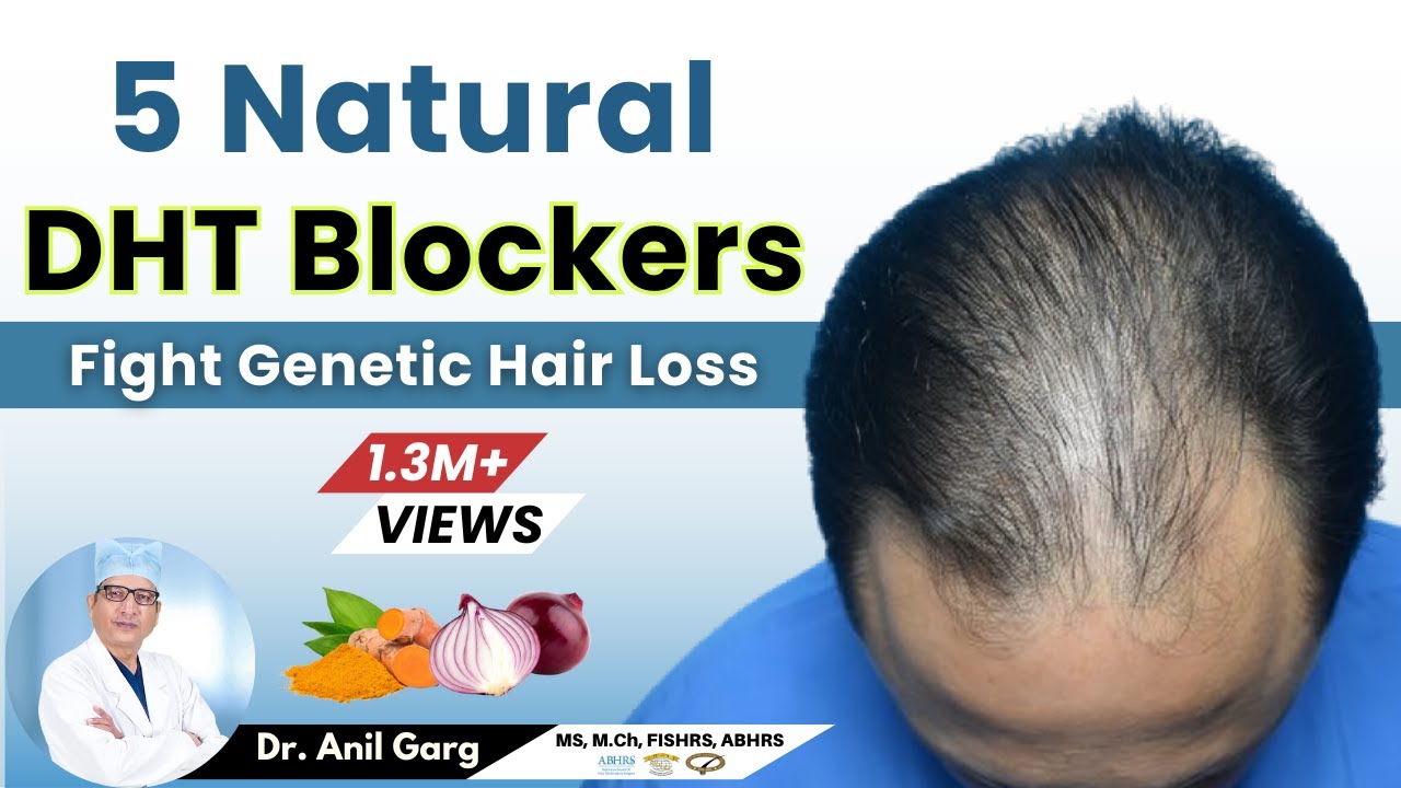 13 Best Natural DHT Blockers that Work  Hairguard