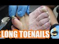 TRIMMING SUPER THICK AND LONG TOENAILS