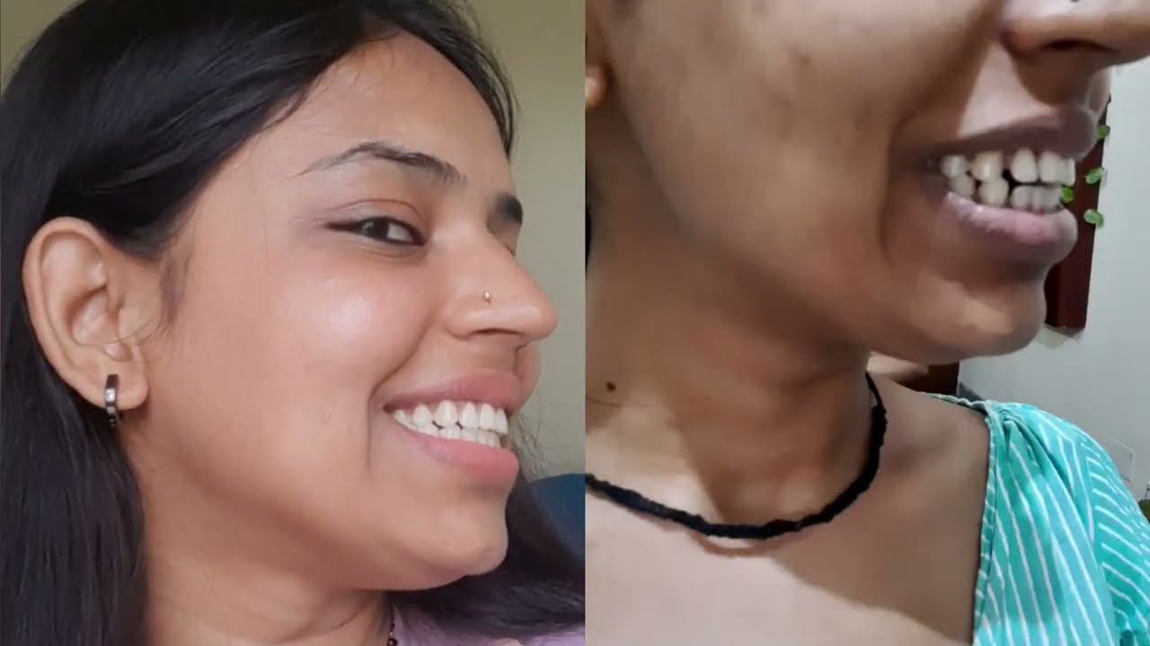 Wait is over! The Final Review of 