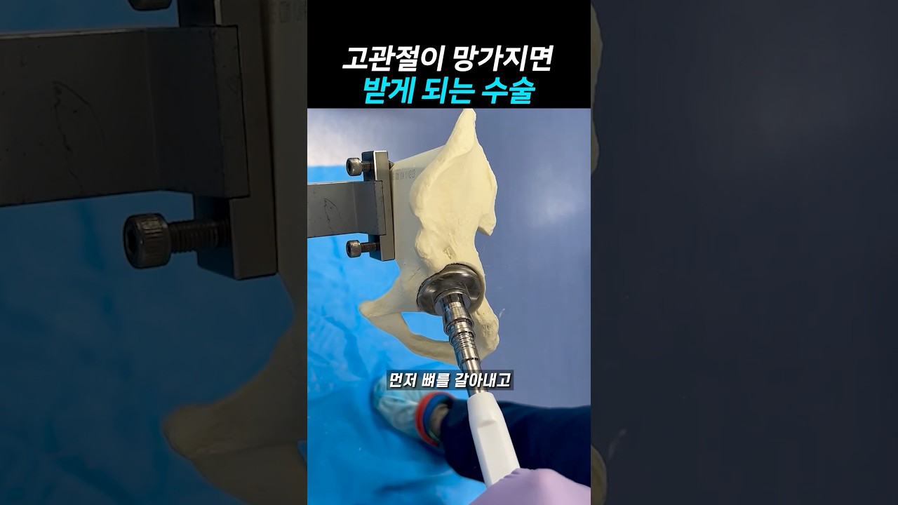 고관절이 망가지면 받게 되는 수술