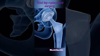 Total hip replacement surgery♡3danimation#nursing#ytshort#viral #anatomy#anatomy#Ritu_nursing_notes
